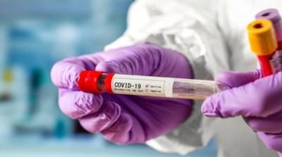 В НАН назвали эпицентры коронавируса в Украине
