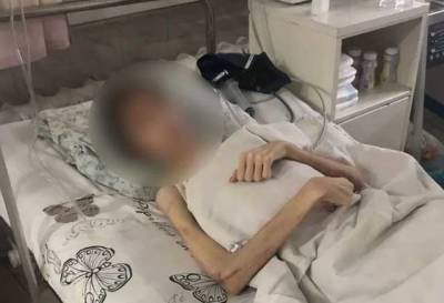 Отец, заморивший голодом 16-летнего сына, рассказал, почему не кормил его и как появились гематомы