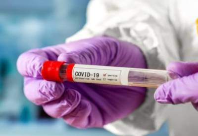 Украине грозит взрывной рост заболеваемости коронавирусом – НАН