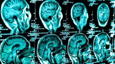 Ученикам «Кванториума Дона» показали, как российские ученые исследуют мозг