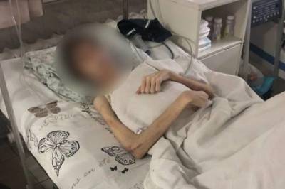 В Одессе отец довёл 16-летнего сына до веса в 30 кг, заставляя поститься, чтобы спастись от бесов