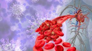 Минздрав: риск тромбозов грозит 20-30 процентам перенесших COVID-19
