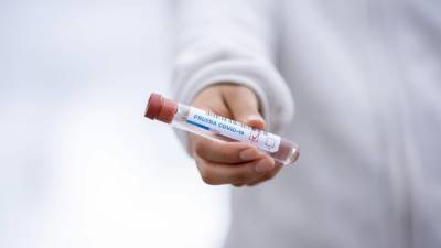 Стало известно о преимуществах экспресс-тестов на антиген к коронавирусу
