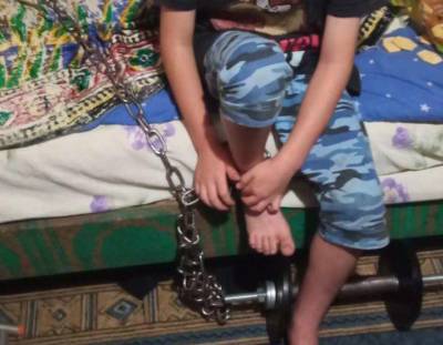 На Днепропетровщине семилетнего ребенка держали на цепи