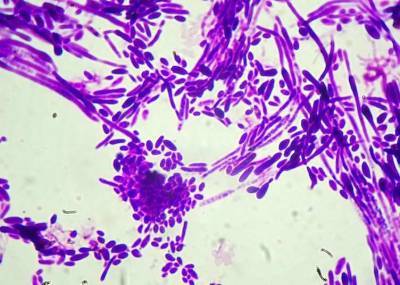 В США выявлены вспышки заражения устойчивым к лекарствам грибком Candida auris