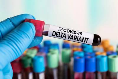 В Киев прибыли тесты для выявления дельта-штамма коронавируса – Рубан