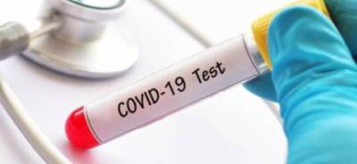 В Минздраве Чувашии опровергли данные о низком охвате тестирования на COVID-19