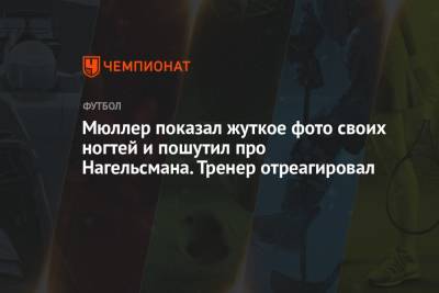 Мюллер показал жуткое фото своих ногтей и пошутил про Нагельсмана. Тренер отреагировал