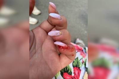 Выдернула ноготь, порвала платье: две женщины подрались на детской площадке в Мурино