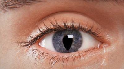 Что такое «змеиные глаза» и как это лечат у людей — ответы врача