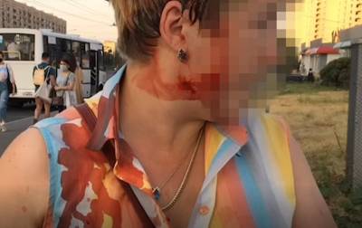 Видео: в Петербурге ребенок на самокате врезался в прохожую – за это его мать еще и избила пострадавшую