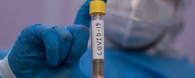 На Алтае зафиксировано 58 новых случаев заболевания коронавирусом