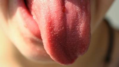 Тревожные признаки рака полости рта перечислили ученые