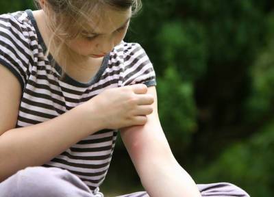 Первая помощь: чем помазать ребенка при кожном зуде после укусов насекомых