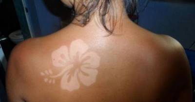 Любителям "солнечных тату" напомнили о риске онкологии