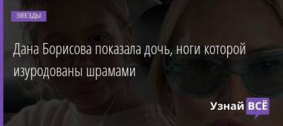 Дана Борисова показала дочь, ноги которой изуродованы шрамами
