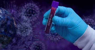 Зарегистрировано 28 новых случаев инфицирования коронавирусом