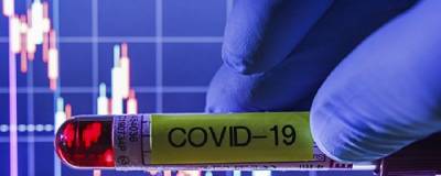 Во Владимирской области выявлено 237 случаев заражения COVID-19