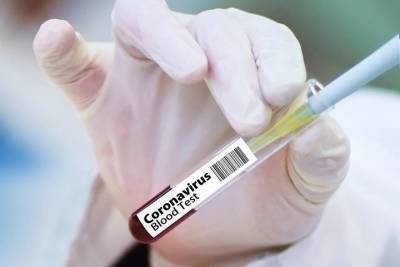 Более 6 тысяч смолян наблюдают медики по коронавирусу