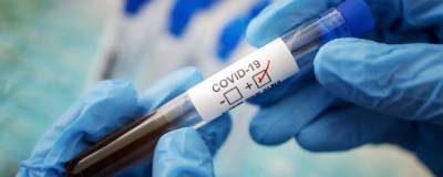 Ученые выяснили, почему мужчины тяжелее переносят коронавирус