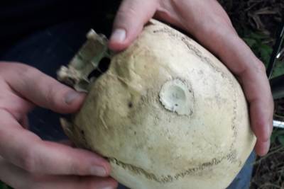 В средневековом склепе Ингушетии нашли череп женщины со следами трепанации