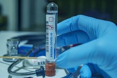 В Чувашии вновь нашли больше 60 заболевших коронавирусом