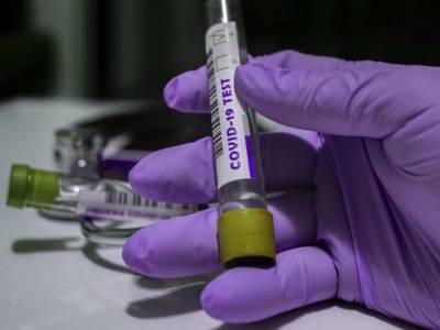 С начала эпидемии коронавируса более одиннадцати миллионов украинцев сдали ПЦР-тесты
