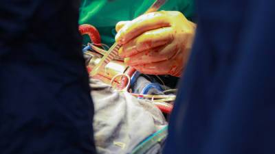 В Кабардино-Балкарии врачи избавили пациента от иглы в легком