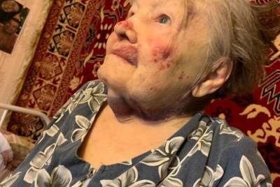 В Екатеринбурге возбудили уголовное дело после избиения 95-летней пенсионерки
