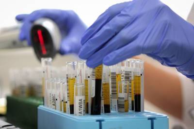 В Курской области сделали свыше 1 млн тестов на коронавирус