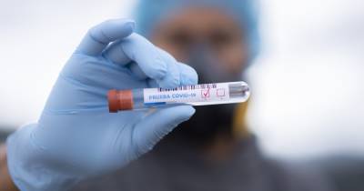За сутки в Украине коронавирус обнаружили у более чем 1100 человек