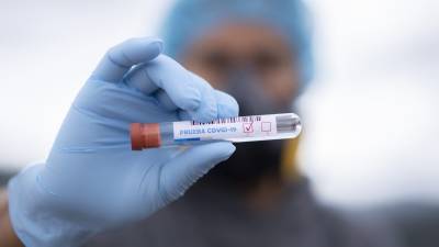 Новый штамм коронавируса "Йота" обладает летальностью 82%