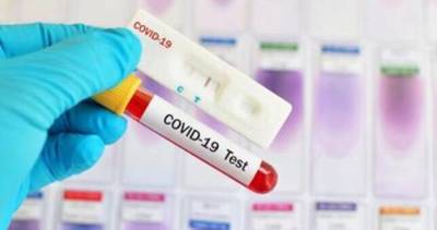 70 новых случаев заражения коронавирусом за сутки