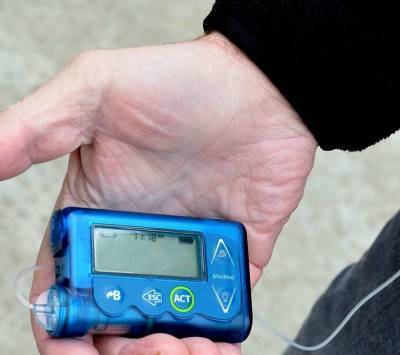 Эксперты назвали основные признаки повышения уровня сахара в крови