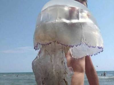 «Таких еще не видела»: медузы продолжают атаковать пляжи Кирилловки