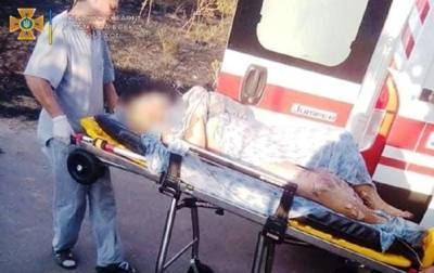 На Николаевщине пенсионерка жгла мусор и попала в больницу