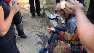Следователи проверят случай нападения стаи собак на женщину в Воронеже
