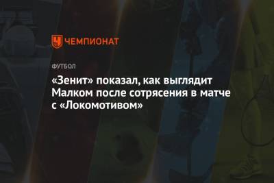 «Зенит» показал, как выглядит Малком после сотрясения в матче с «Локомотивом»