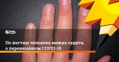 По ногтям человека можно судить о перенесенном COVID-19