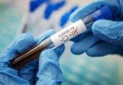 В Украине за сутки обнаружили 1560 новых случаев коронавируса