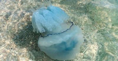 Катастрофа с медузами в Азовском море: Минздрав выпустил рекомендации для отдыхающих