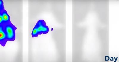 Учёные записали на видео, как коронавирус попадает из носа в мозг