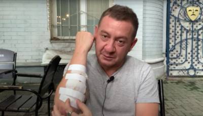 Пьяный Муждабаев упал и покалечился в центре Киева