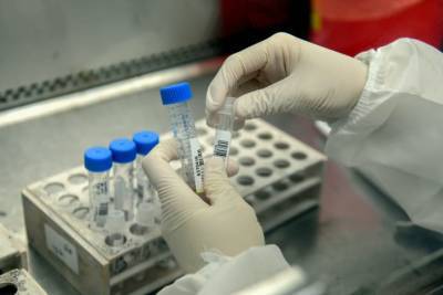 Медики назвали новые неожиданные признаки перенесенного коронавируса и мира