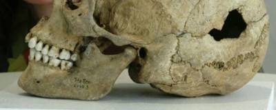 Ученые РАН: древние хирурги делали трепанацию черепа живым людям в ритуальных целях