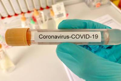 В Новгородской области коронавирусом заболели еще 126 человек