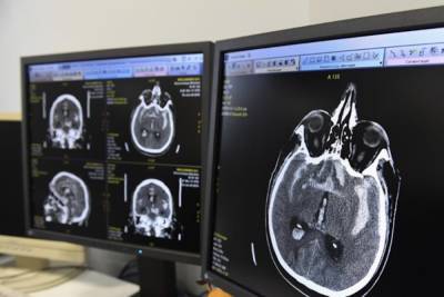 В ИТМО научили нейросеть распознавать опухоли мозга