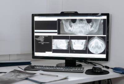 В Свирской и Гатчинской больницах завершают ремонт рентген-кабинетов