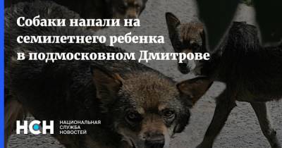 Собаки напали на семилетнего ребенка в подмосковном Дмитрове