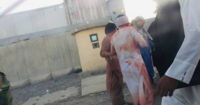Взрывы в Кабуле: число жертв существенно увеличилось